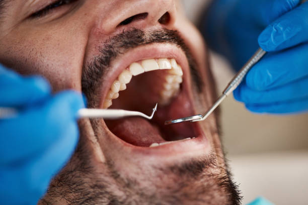 Best Emergency Dentist for Knocked-Out Tooth in Prattville, AL