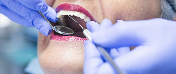 Best Broken or Cracked Tooth Emergency Dentist in Prattville, AL
